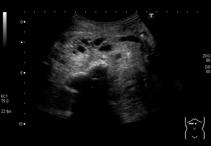  Cystex が作用するまでどのくらい時間がかかりますか?