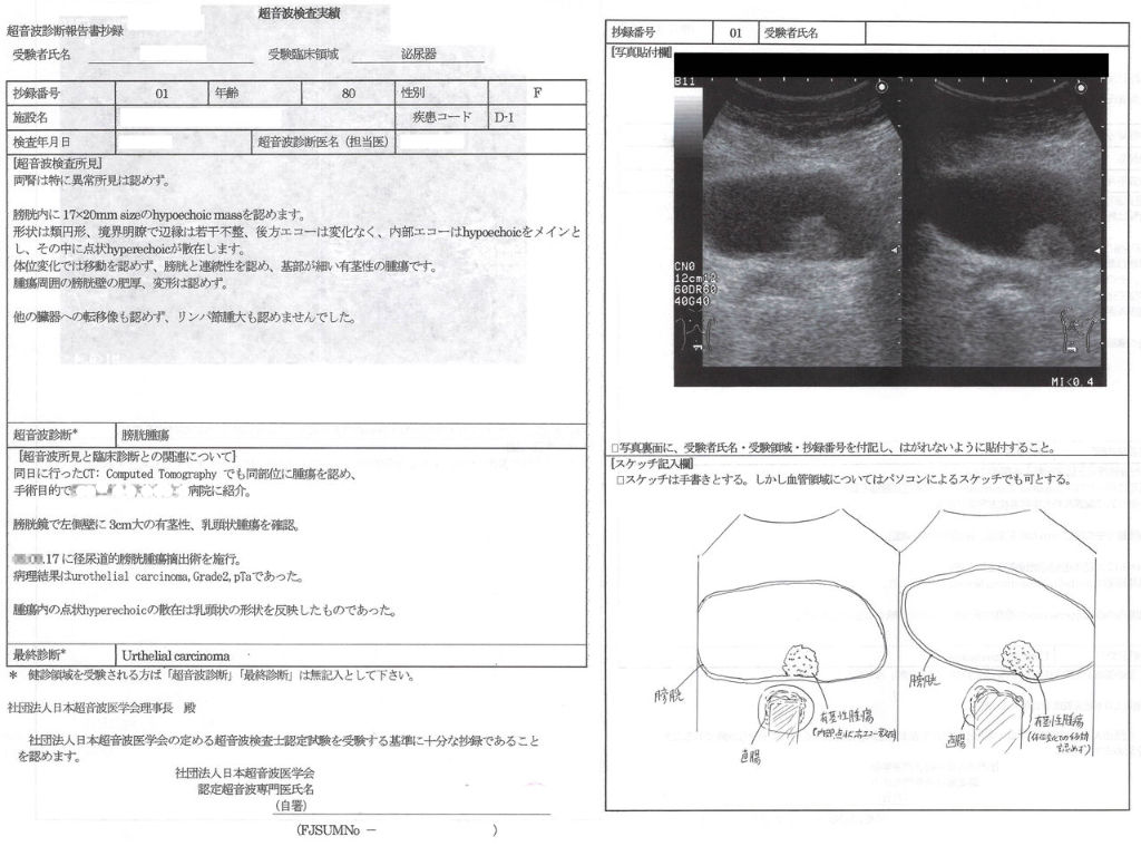 超音波検査実績 その1 Yanchangの現在修行中