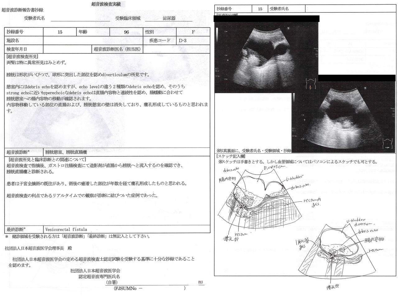 超音波検査報告書の書き方 : 「おっ」と思わせる! 消化器/消化管