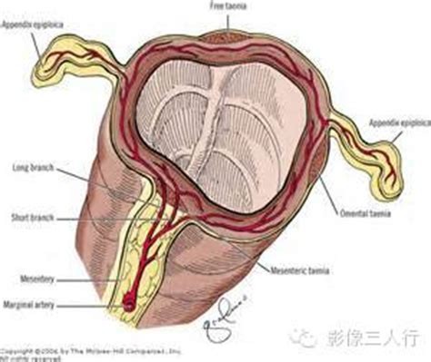腹膜垂01