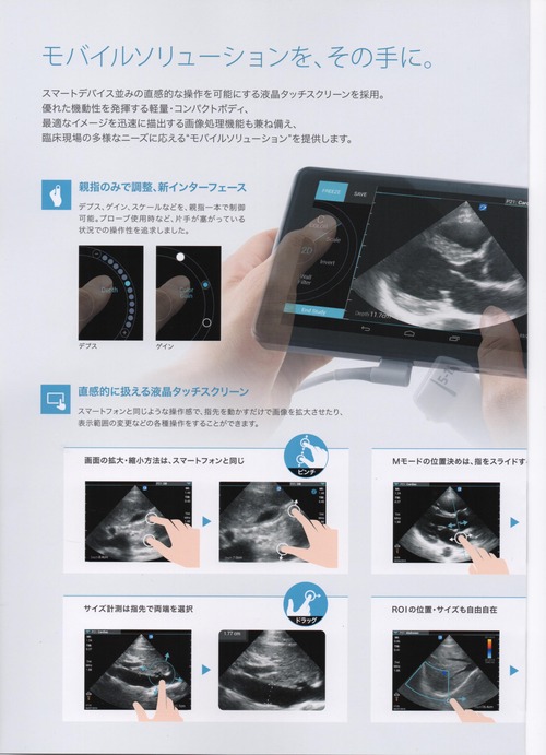 (FUJIFILM)(SonoSite)¡ÚiViz¡Û02