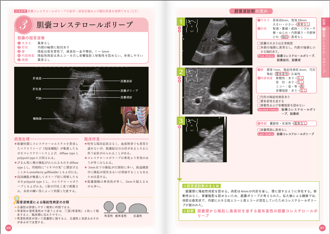 新超音波検査 消化管 関根 智紀 Amazon.co.jp: 新超音波検査 消化管 : 関根 智紀: Japanese Books