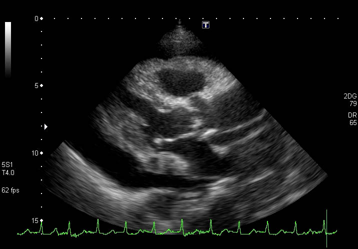 yanchangの現在修行中 症例集 2011.07.13