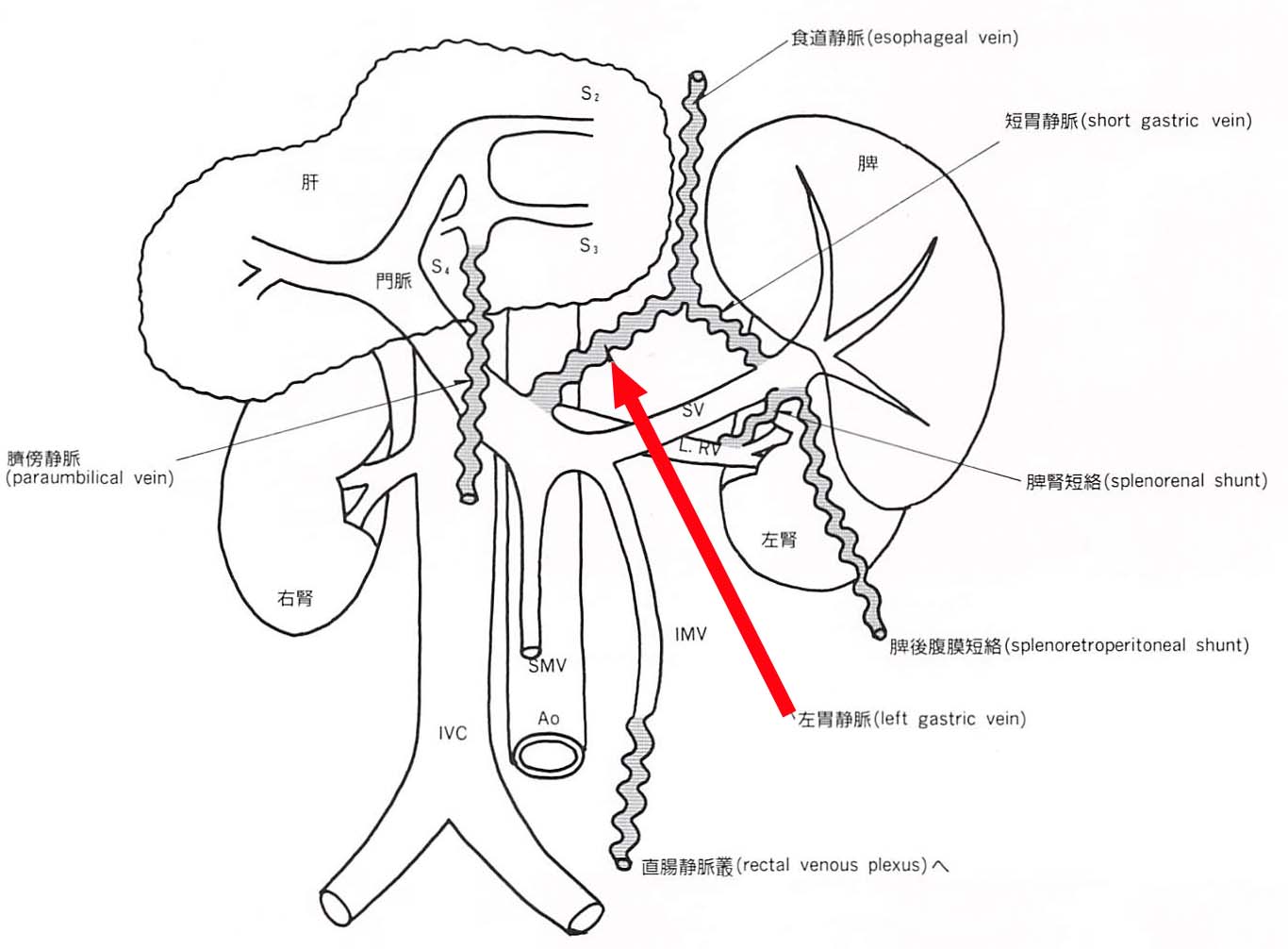 症例集 2012 11 1４ Yanchangの現在修行中