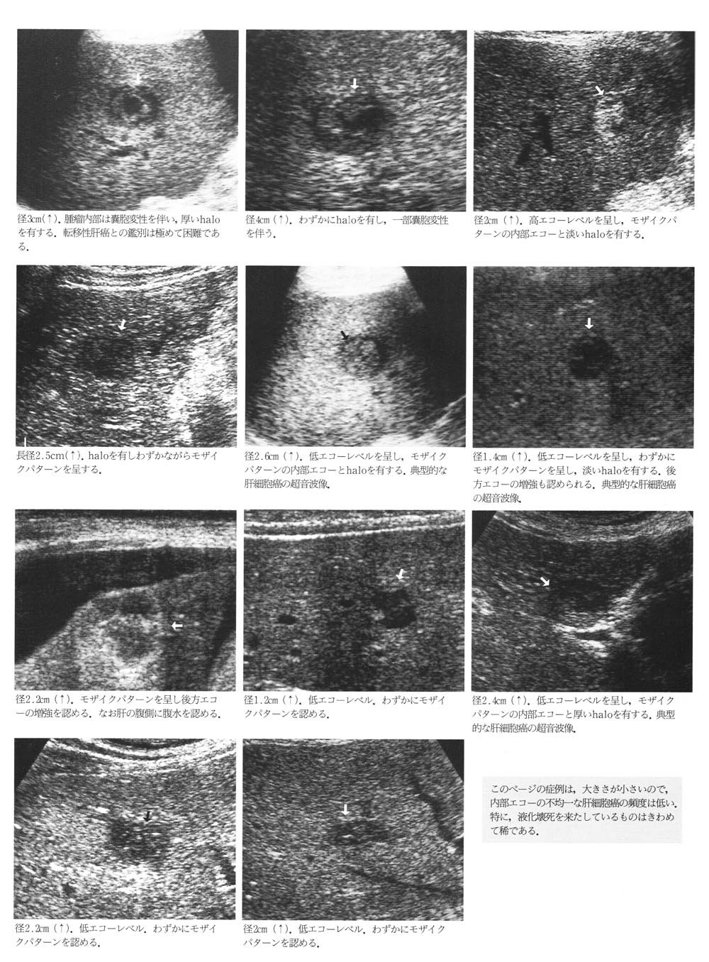 【メーカー直送】 2nd yanchangの : 文雄 幸夫、辻本 step超音波診断「肝」:宮本 健康+医学