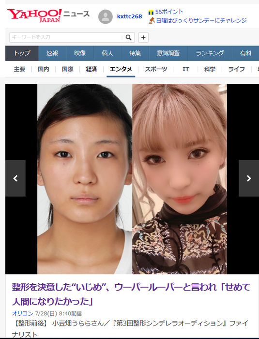 画像あり ウーパールーパー と言われいじめられていた女の子が整形をした結果 やるきまんまん