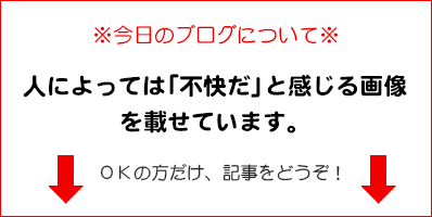 閲覧注意