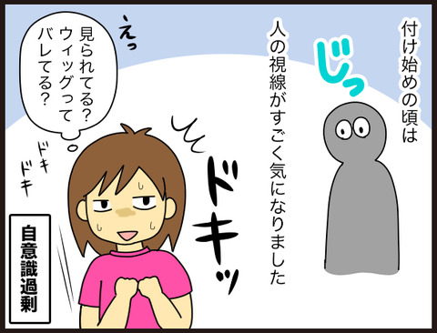 【髪】部分ウィッグってどんな感じ?2