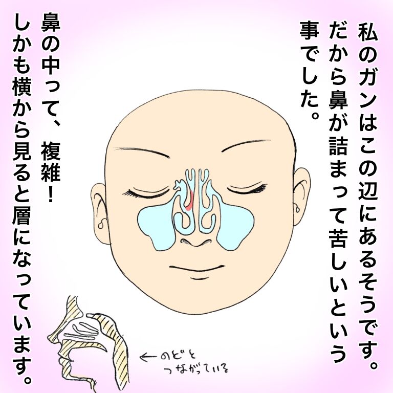 鼻腔ガンになった話 入院編 第6話 やよいかめブログ Powered By ライブドアブログ