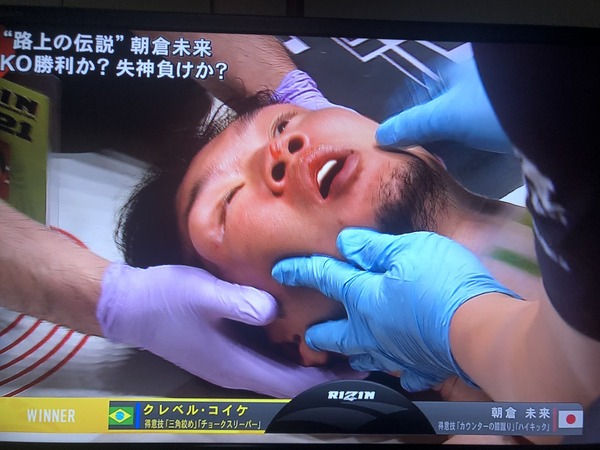 失神敗戦の朝倉未来、引退も選択肢「クレベルは結果的に ...