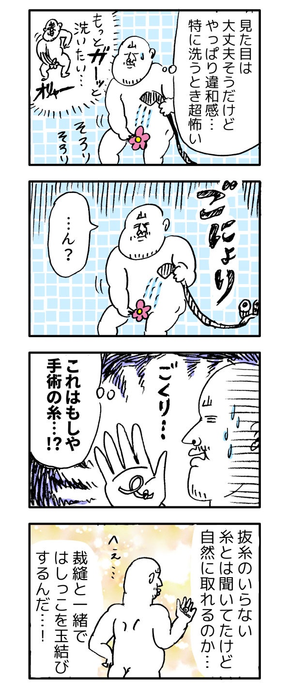 下半身の話注意 産後の手術跡が気になりすぎて わっしょい ヒゲ母ちゃん Powered By ライブドアブログ