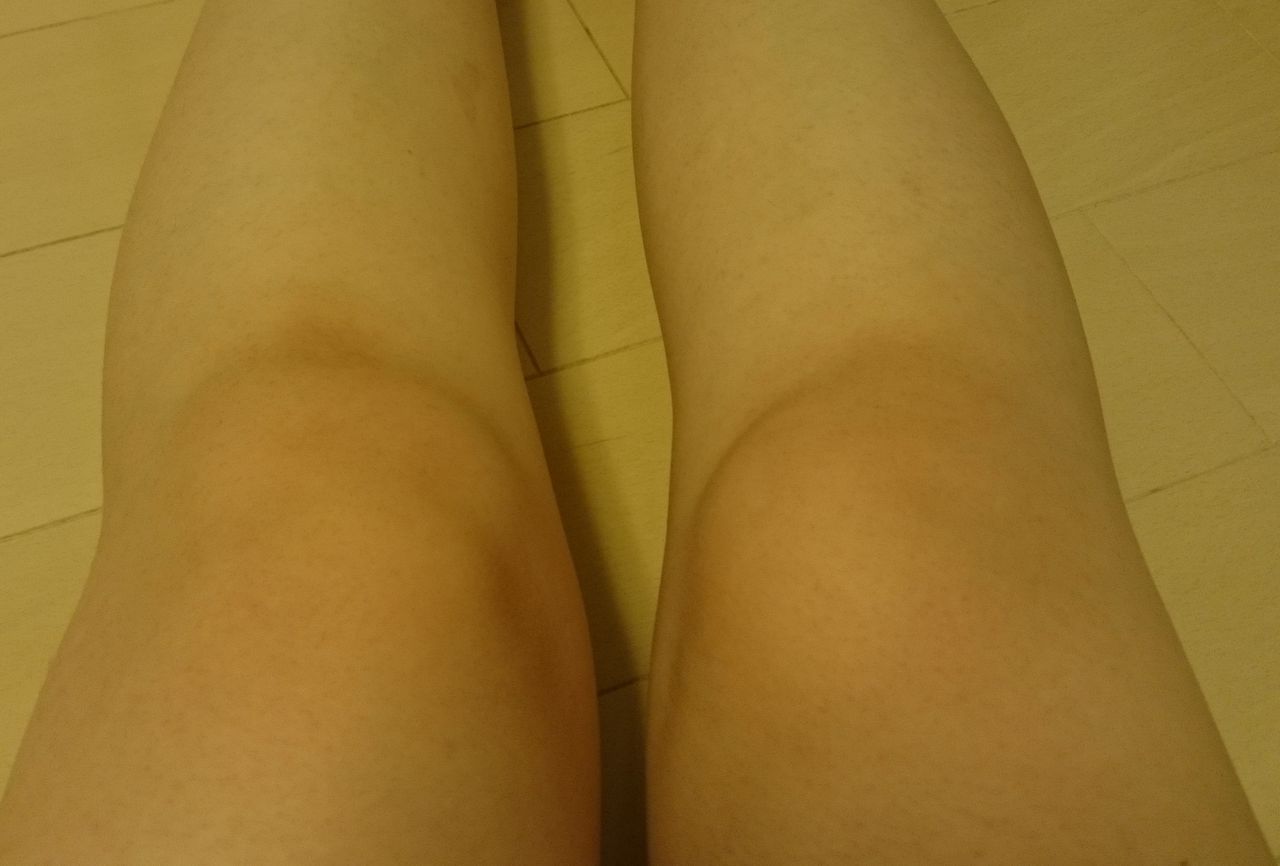 重曹を使った膝黒ずみケアを試してみました ガーターベルト ストッキング研究所 重曹を使った膝黒ずみケアを試してみました ガーターベルト ストッキング研究所