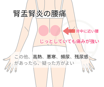 腎盂腎炎の腰痛