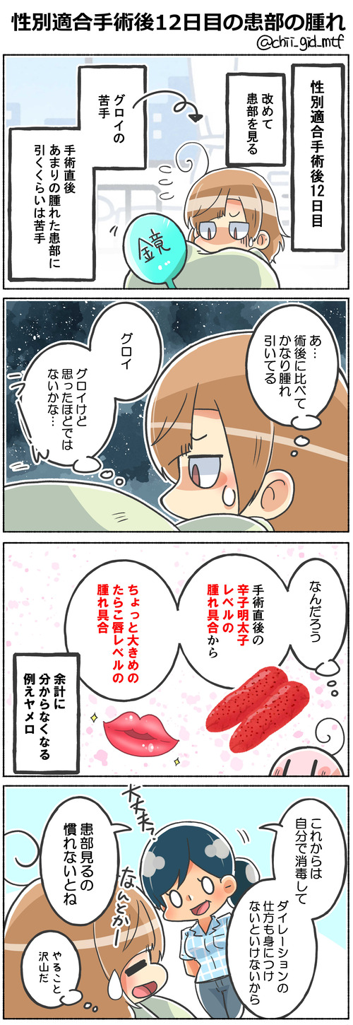 性別適合手術後12日目の幹部の腫れ