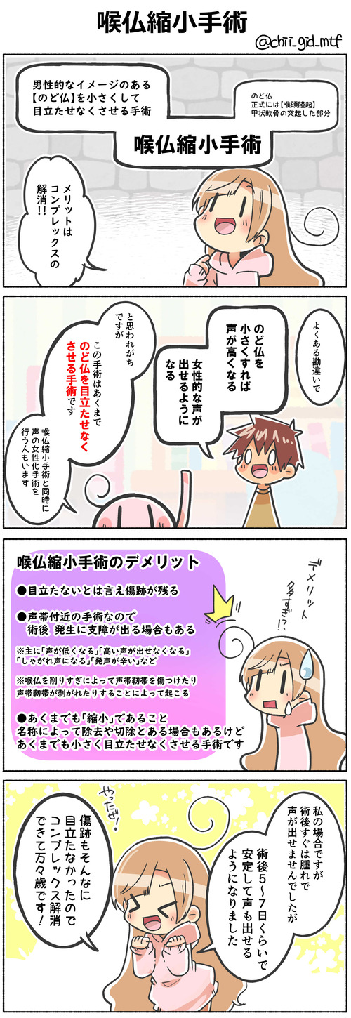 喉仏縮小手術