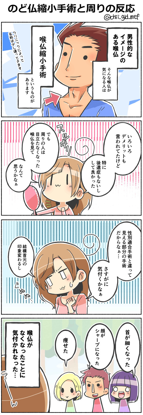 のど仏縮小手術と周りの反応