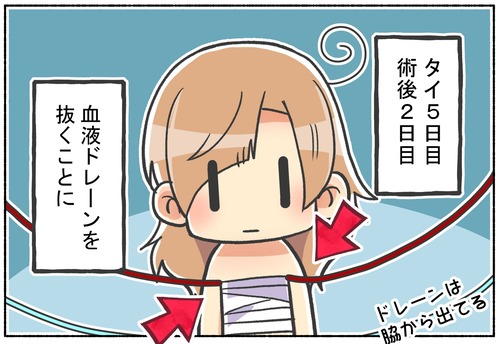 【性別適合手術】術後の血液ドレーンを抜く【元男子】