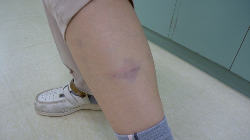 犬に噛まれたと思って 旧々吉浜歯科のblog 犬に噛まれたと思って 旧々吉浜歯科のblog