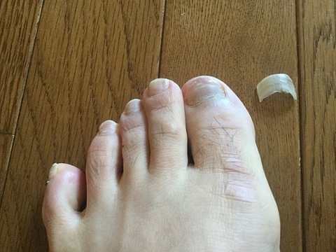 爪の生え変わり 葦の気づきノート 爪の生え変わり 葦の気づきノート