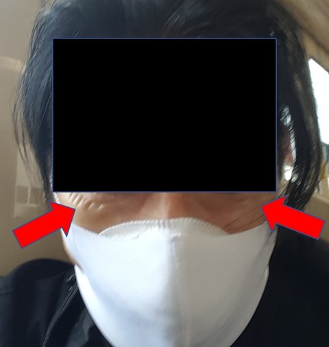 ２２図1