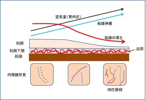 ４４図1