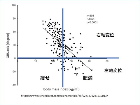 健常者の心電図異常 宇野コラム Uno Column 健常者の心電図異常 宇野コラム Uno Column