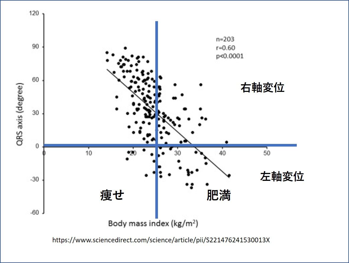 健常者の心電図異常 宇野コラム Uno Column
