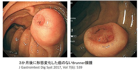 １
