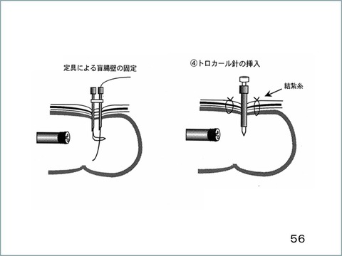 56図1