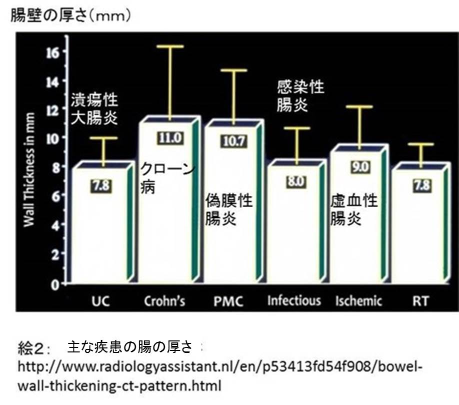 オブジェクション ポッコリお腹が むくみ腸 宇野コラム Uno Column オブジェクション ポッコリお腹が むくみ腸 宇野コラム Uno Column