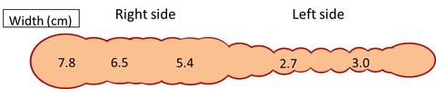 u0