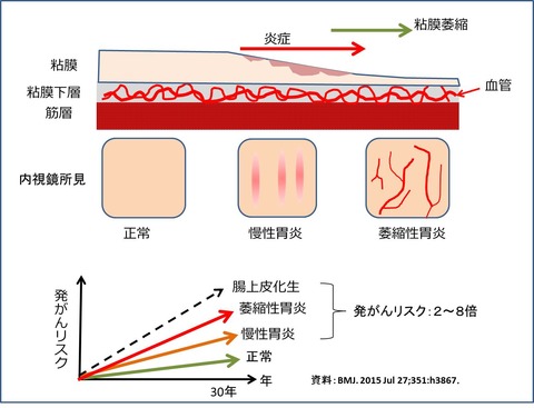 説明健診