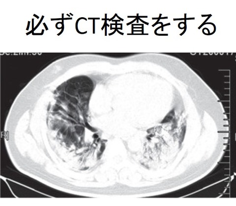 CT1図1