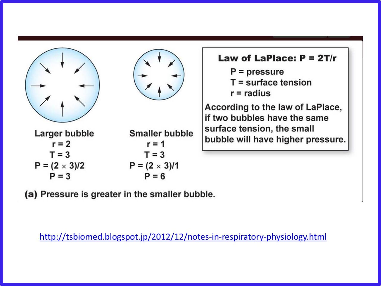 Contradiction Of Laplace S Law In Diverticular Disease 宇野コラム Uno Column
