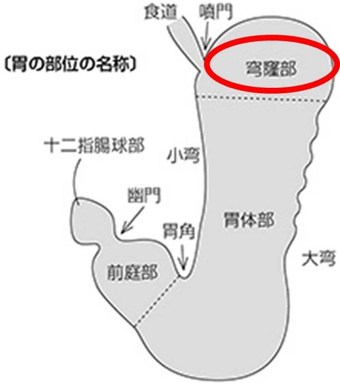 １１図1