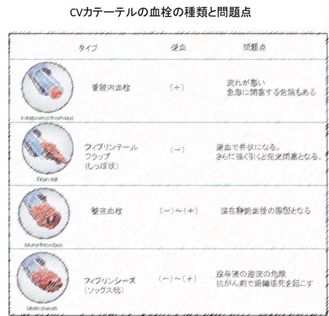 CV０