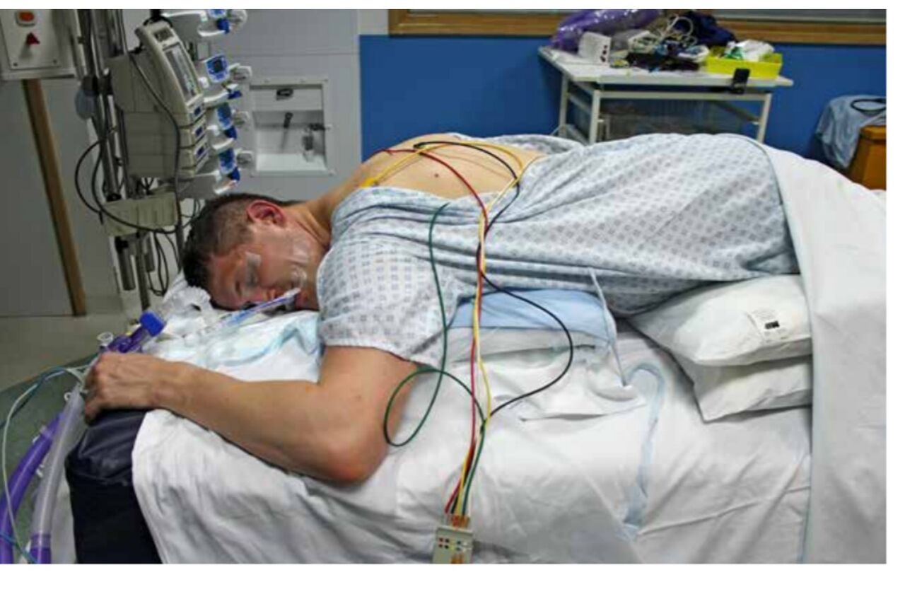 更新5 新型コロナの人工呼吸器 腹臥位にしてください 宇野コラム Uno Column