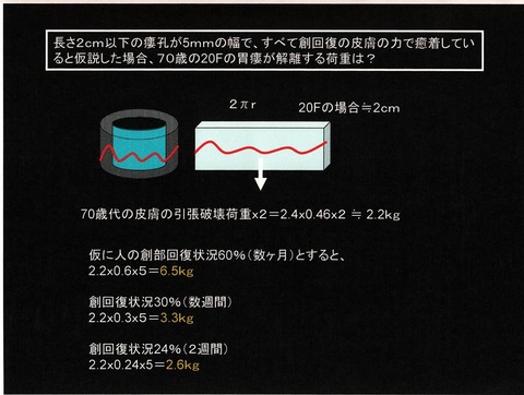 115図1