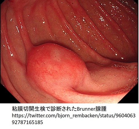 １