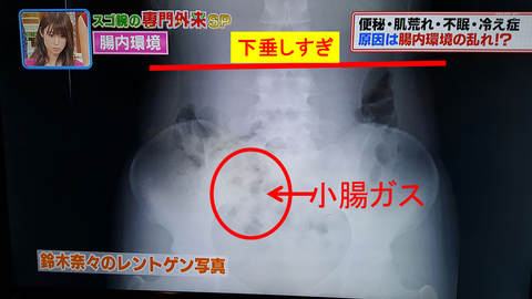 憤怒