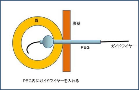 かくちょう１図1