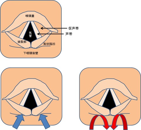 ２２図1
