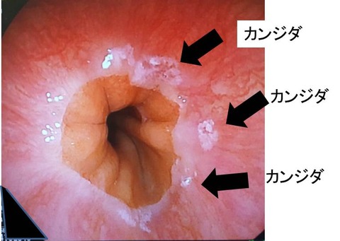 １図1