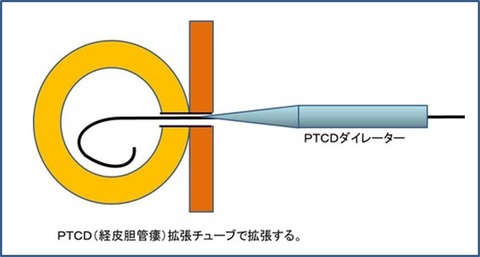 かくちょう３