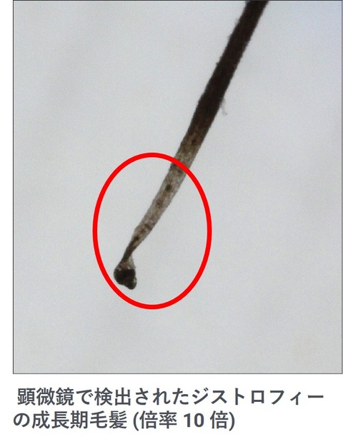 ３