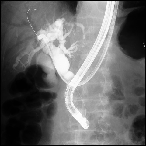 20120410ERCP0023指定された1枚です