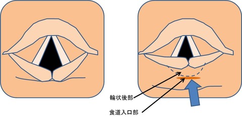 ３３図1