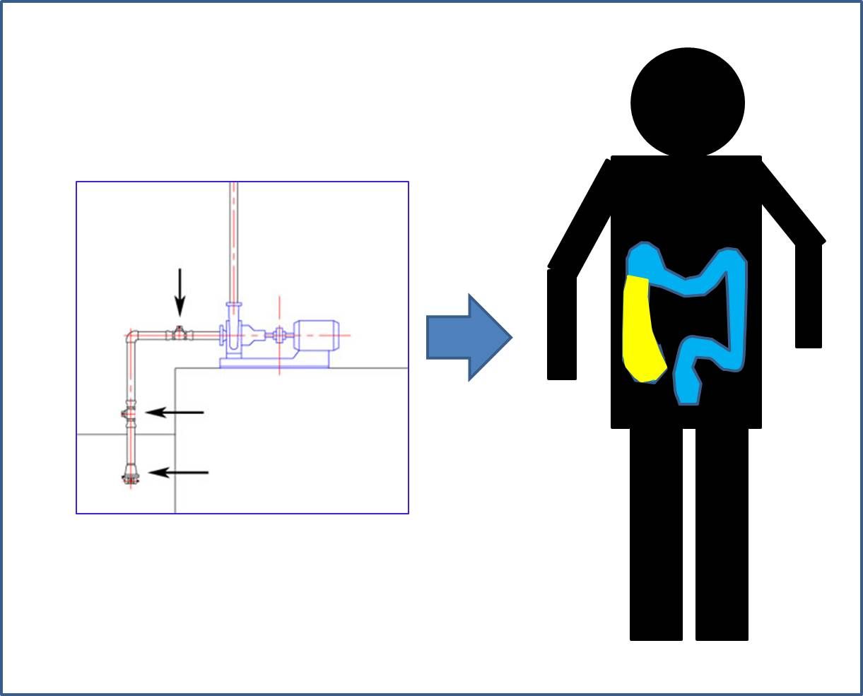 大腸ガスが残る理由 ポンプのエア噛み 宇野コラム Uno Column