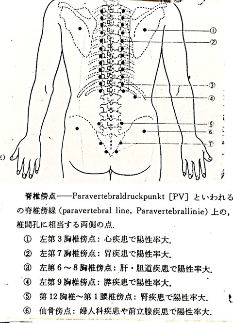 背部痛