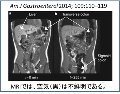 MRI2